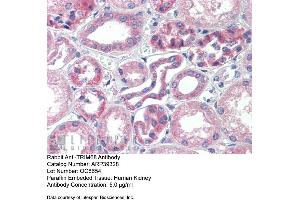 Immunohistochemistry with Human kidney lysate tissue at an antibody concentration of 5.
