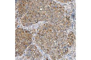 IHC analysis of SLC40A1 using anti-SLC40A1 antibody (ABIN7599484).