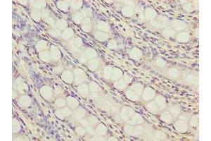 Immunohistochemistry of paraffin-embedded human colon tissue using ABIN7166380 at dilution of 1:100 (ZNF767P antibody  (AA 1-118))