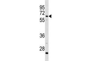 C8B antibody western blot analysis in CEM lysate (C8B antibody  (AA 393-422))