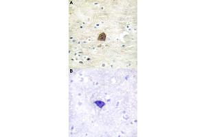 Immunohistochemical staining (Formalin-fixed paraffin-embedded sections) of human brain tissue with CAMK2A/CAMK2B/CAMK2D (phospho T305) polyclonal antibody  without blocking peptide (A) or preincubated with blocking peptide (B) under 1:50-1:100 dilution. (CAMK2A antibody  (pThr305))