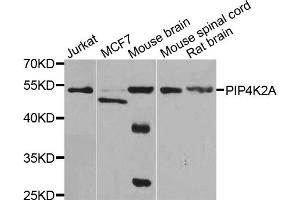 Western blot analysis of extracts of various cell lines, using PIP4K2A antibody. (PIP4K2A antibody)