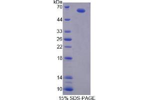 Image no. 1 for Vav 1 Oncogene (VAV1) (AA 426-696) protein (His tag,GST tag) (ABIN6238353) (VAV1 Protein (AA 426-696) (His tag,GST tag))