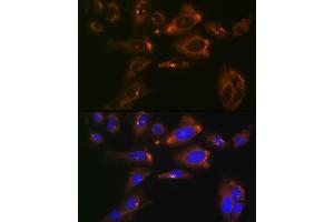 Immunofluorescence analysis of U-2 OS cells using ACLY Rabbit mAb (ABIN1678575, ABIN7101559, ABIN7101560 and ABIN7101561) at dilution of 1:100 (40x lens). (ACLY antibody)