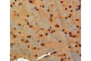 IHC-P analysis of brain tissue, with DAB staining. (GAD antibody  (AA 1-97))