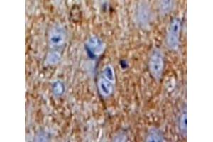 Used in DAB staining on fromalin fixed paraffin-embedded Brain tissue (SOD4 antibody  (AA 17-270))