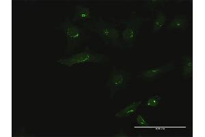 Immunofluorescence of purified MaxPab antibody to B3GALT6 on HeLa cell. (B3GALT6 antibody  (AA 1-329))