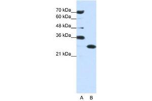 WB Suggested Anti-ANP32A  Antibody Titration: 0. (PHAP1 antibody  (Middle Region))