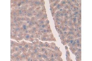 Figure. (Vitamin D-Binding Protein antibody  (AA 395-473))