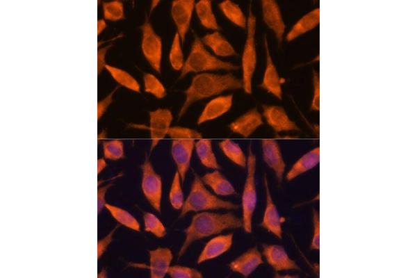 Secernin 3 antibody  (AA 100-410)