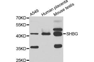 Western blot analysis of extracts of various cell lines, using SHBG antibody (ABIN5975291) at 1/1000 dilution. (SHBG antibody)