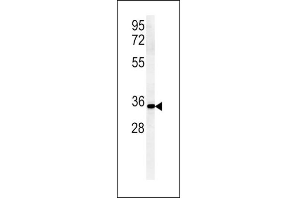 ZDHHC2 antibody  (AA 77-106)