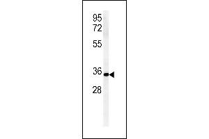 ZDHHC2 antibody  (AA 77-106)