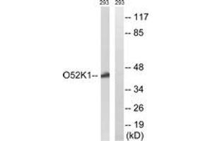 Western blot analysis of extracts from 293 cells, using OR52K1 Antibody. (OR52K1 antibody  (AA 201-250))