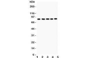 Western blot testing of FOXM1 antibody and Lane 1:  HeLa;  2: COLO320;  3: SW620;  4: SKOV;  5: MCD-7. (FOXM1 antibody  (AA 411-763))