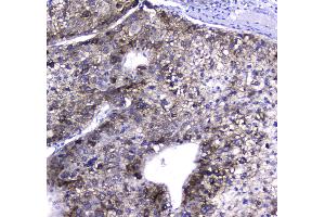 IHC analysis of HGD using anti-HGD antibody . (HGD antibody  (AA 374-445))