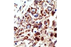 Image no. 2 for anti-Signal Transducing Adaptor Molecule (SH3 Domain and ITAM Motif) 1 (STAM) (C-Term) antibody (ABIN357620)