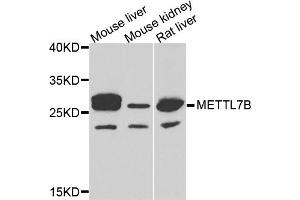 Western blot analysis of extracts of various cell lines, using METTL7B antibody (ABIN5974333) at 1/1000 dilution. (METTL7B antibody)