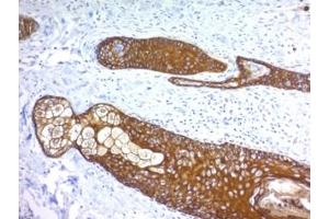 Formalin paraffin human skin stained with Basic Cytokeratin antibody (KRTH/1076). (Keratin Basic antibody)