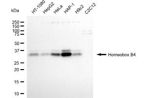 Western blotting analysis using homeobox B4 antibody (ABIN7798992).