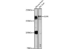 Western blot analysis of extracts of various cell lines, using EGFR antibody (ABIN7266982) at 1:1000 dilution. (EGFR antibody  (AA 1021-1210))