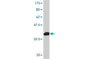 Western Blot detection against Immunogen (37. (FOXC2 antibody  (AA 156-256))