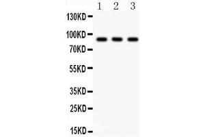 Anti-CTCF Picoband antibody, Western blotting All lanes: Anti CTCF  at 0. (CTCF antibody  (AA 521-727))