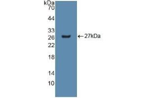 Detection of Recombinant GSTm2, Human using Polyclonal Antibody to Glutathione S Transferase Mu 2 (GSTM2) (GSTM2 antibody  (AA 3-218))