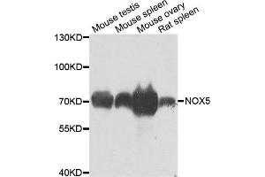 Western blot analysis of extracts of various cell lines, using NOX5 antibody. (NOX5 antibody)