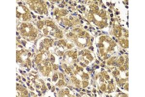 Immunohistochemistry of paraffin-embedded Human gastric using HSPE1 Polyclonal Antibody at dilution of 1:100 (40x lens). (HSPE1 antibody)