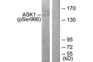 Western blot analysis of extracts from 293 cells treated with TNF(20ng/ml)+calyculinA(50nM) 15', using ASK1 (Phospho-Ser966) Antibody. (ASK1 antibody  (pSer966))