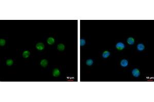 ICC/IF Image RPL17P7 antibody detects RPL17P7 protein at cytoplasm by immunofluorescent analysis. (RPL17P7 antibody  (Center))