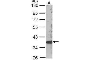 WB Image Sample (30 ug of whole cell lysate) A: Hep G2 , 10% SDS PAGE SCAP2 antibody antibody diluted at 1:1000 (SKAP2 antibody  (C-Term))