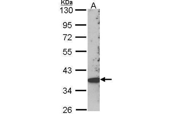SKAP2 anticorps  (C-Term)