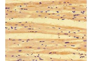 Immunohistochemistry of paraffin-embedded human heart tissue using ABIN7163828 at dilution of 1:100 (PKD1L3 antibody  (AA 22-194))