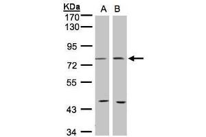 WB Image Sample(30 ug whole cell lysate) A:293T B:MOLT4 , 7. (PTGS2 antibody  (C-Term))