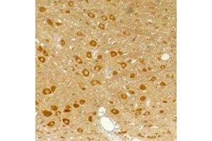 Immunohistochemical analysis of GABRA3 staining in rat brain,mouse brain formalin fixed paraffin embedded tissue section. (GABRA3 antibody)