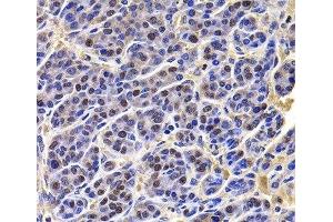 Immunohistochemistry (Paraffin-embedded Sections) (IHC (p)) image for anti-HIRA Interacting Protein 3 (HIRIP3) antibody (ABIN7262957)