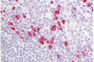 Anti-PAK1/2/3 antibody IHC staining of human tonsil. (PAK1/2/3 antibody  (AA 391-440))