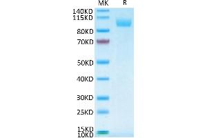 Human Siglec-5 on Tris-Bis PAGE under reduced conditions. (SIGLEC5 Protein (AA 17-434) (Fc Tag))