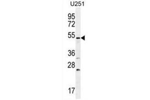 BMPR1B Antibody (Center) western blot analysis in U251 cell line lysates (35µg/lane). (BMPR1B antibody  (Middle Region))