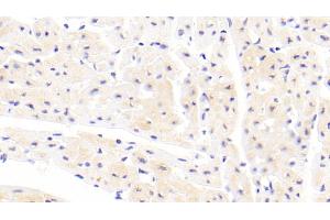 Detection of CFL2 in Human Cardiac Muscle Tissue using Polyclonal Antibody to Cofilin 2, Muscle (CFL2) (Cofilin 2 antibody  (AA 1-156))