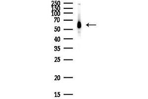 Western blot analysis of lysates from HepG2 cells(heat-shock,45 min treatment), using DDX5 Antibody at 1/1000 dilution.