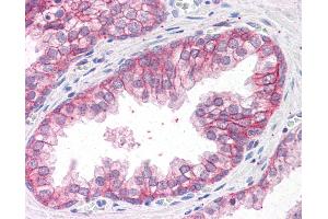 Anti-CTNNA1 antibody IHC of human prostate. (CTNNA1 antibody  (AA 871-883))