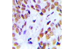 Immunohistochemistry (IHC) image for anti-Nucleophosmin (Nucleolar phosphoprotein B23, Numatrin) (NPM1) (C-Term) antibody (ABIN7304024)