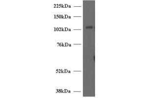Image no. 1 for anti-Unc-13 Homolog D (UNC13D) (Internal Region) antibody (ABIN374716) (UNC13D antibody  (Internal Region))