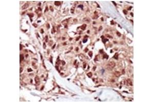 Immunohistochemistry (IHC) image for anti-Bromodomain Containing 4 (BRD4) (AA 1-30) antibody (ABIN3028517)