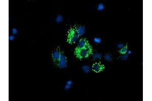 Anti-DLD mouse monoclonal antibody (ABIN2454952) immunofluorescent staining of COS7 cells transiently transfected by pCMV6-ENTRY DLD (RC200639). (DLD antibody)