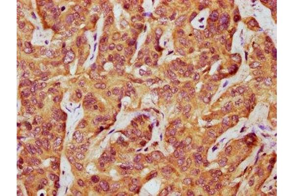 LIMD2 antibody  (AA 1-127)