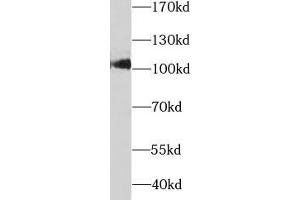 Western blot analysis of rat liver tissue subjected to SDS-PAGE, using SARDH antibody (1/1000 dilution). (SARDH antibody)